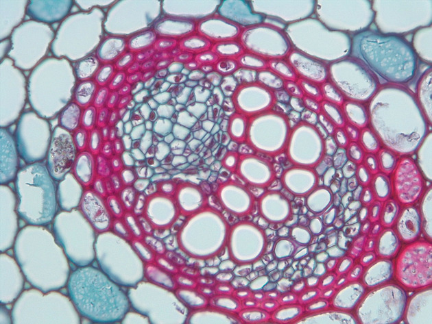 Plant Vascular Tissue Slides - Plant Vascular Tissue 01 400X